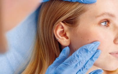 PRP for Skin Rejuvenation and Hair Loss