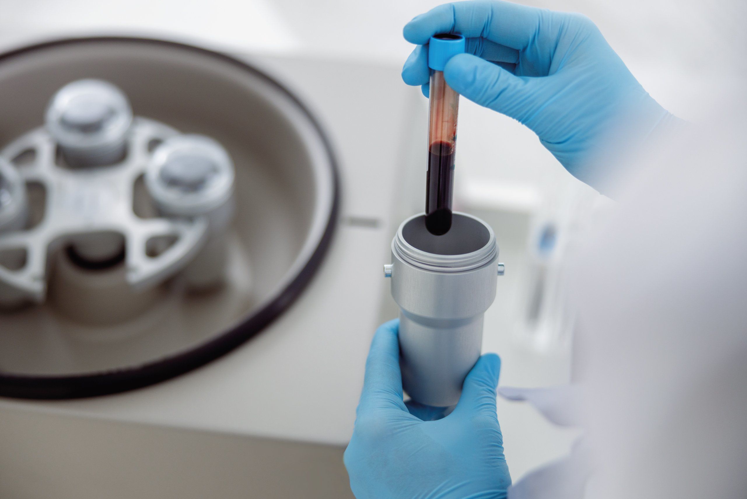 Lipogems Guildford Dentist