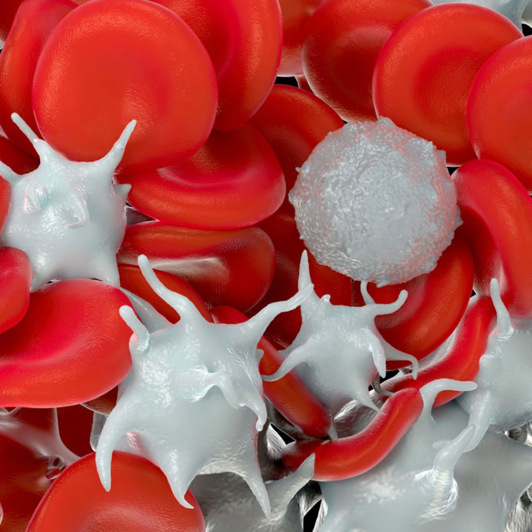 Mast Cell Activation Syndrome Guildford Dentist